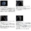 画像4: （26年2月新商品） ダイワ 26 ソルティガ 10HL-SJ（左） （小型商品）